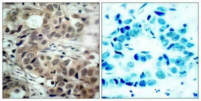Immunohistochemistry-Paraffin: CDC25C [p Ser216] Antibody [NB100-81841]